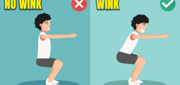 What is Squat Butt Wink & How to Fix It